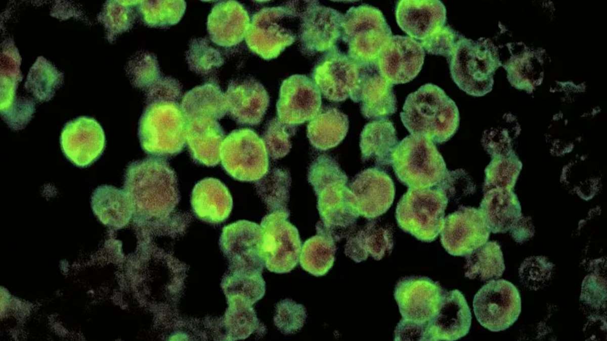 Ameba Naegleria Fowleri Foto CDC Dr. Govinda S. Visvesvara